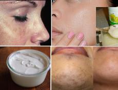 Отбеливание кожи натуральными продуктами эффективно при лечении темных пятен