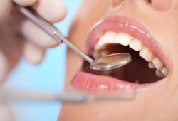 Процедура реставрации зубного ряда